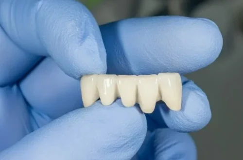 Kiedy ząb wymaga korony, a nie wypełnienia? Kompleksowe spojrzenie kliniczne