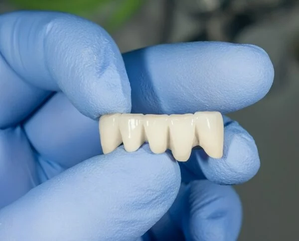 Kiedy ząb wymaga korony, a nie wypełnienia? Kompleksowe spojrzenie kliniczne